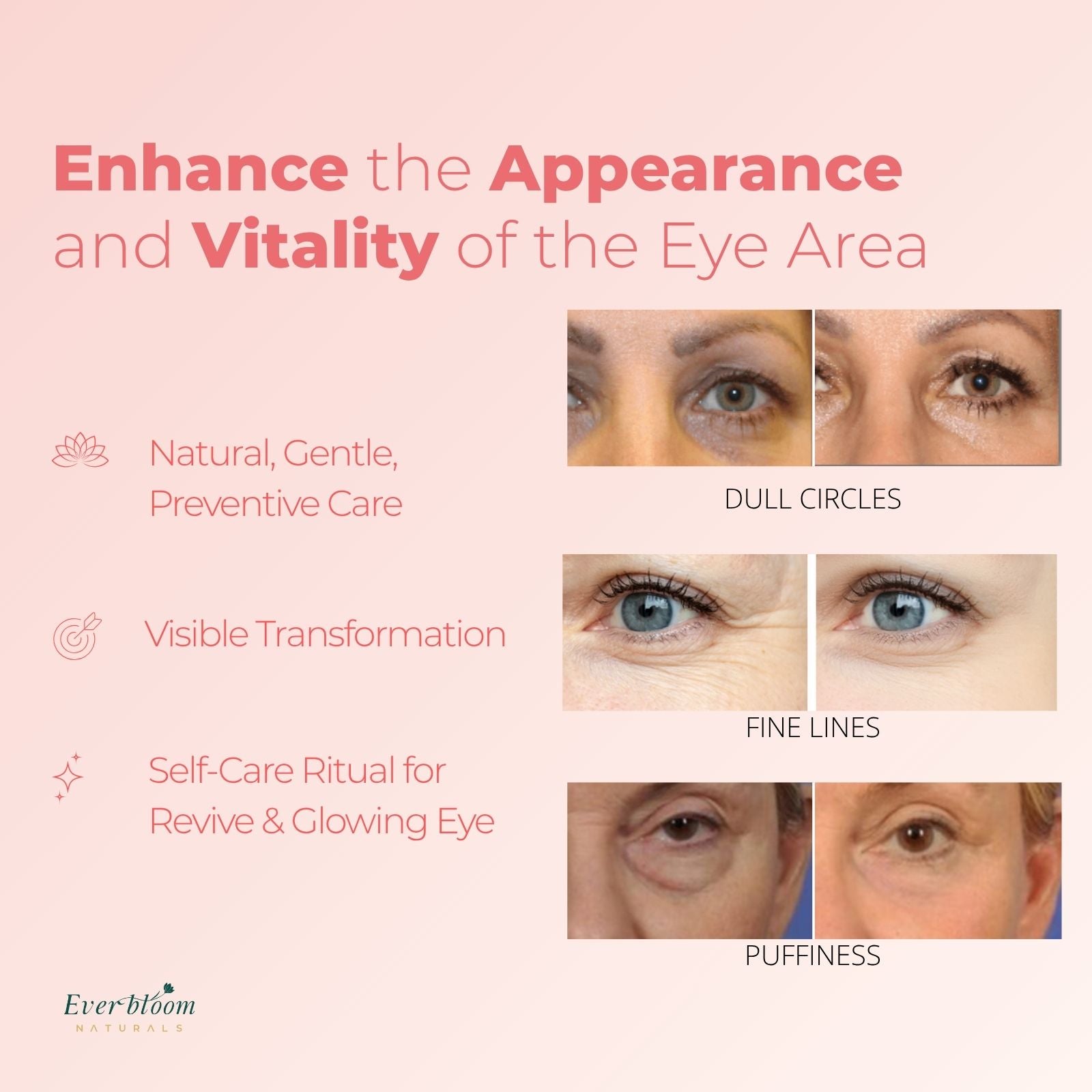 PDRN Eye Serum Compare