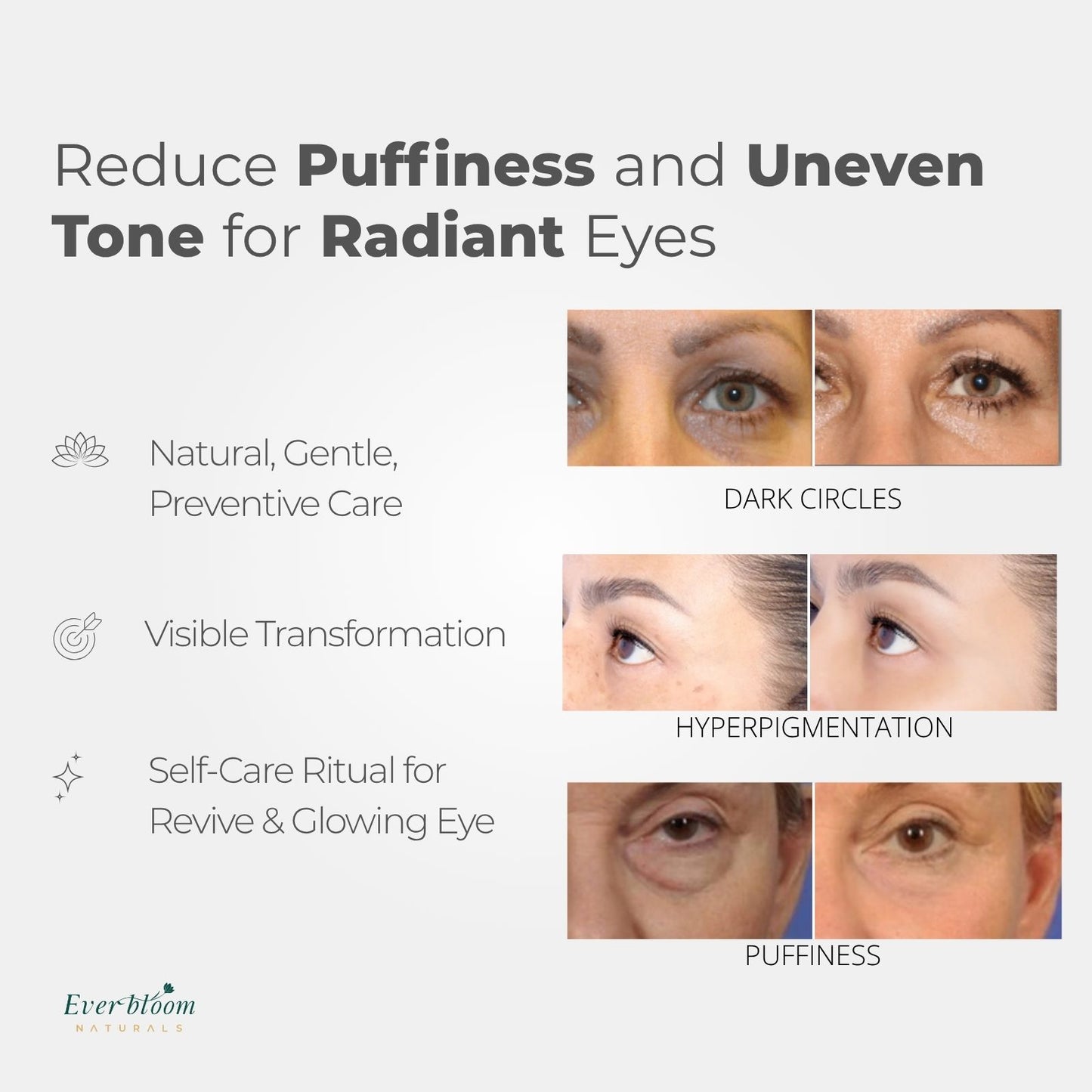 Tranexamic Acid Eye Serum Compare