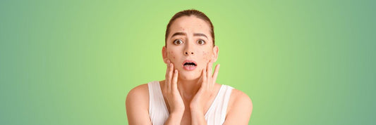 Conference Complexion: Navigating Period Acne During Multi-Day Events