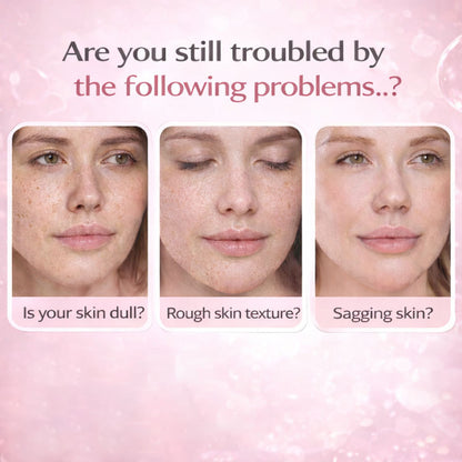 PDRN Pink Collagen Bubble Serum with 99% Salmon DNA, Retinol, Niacinamide & Ceramides, 3.38 fl oz