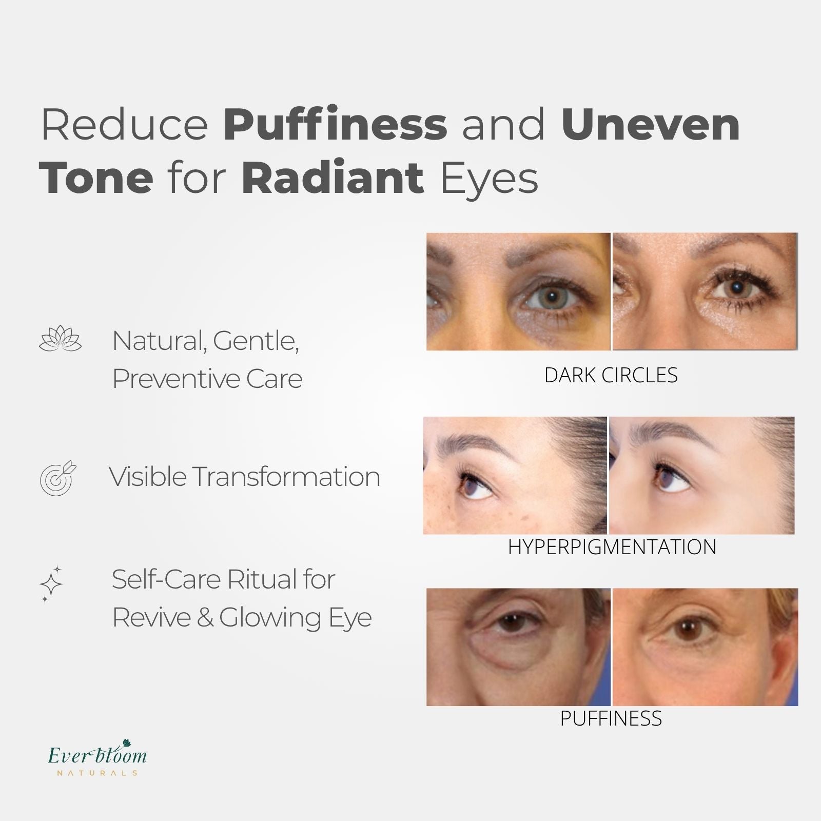 Tranexamic Acid Eye Serum Compare